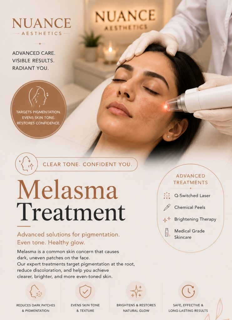 melasma treatment in thrissur